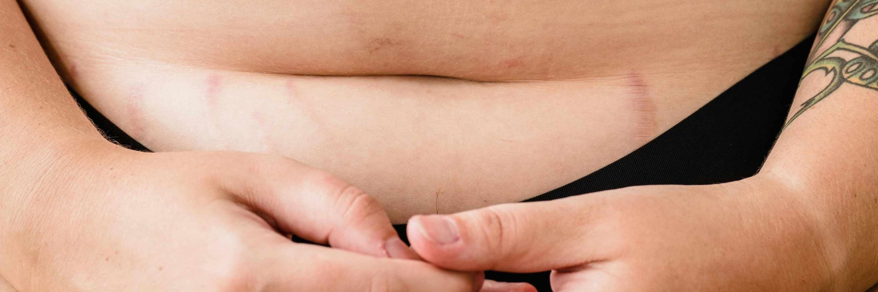 Pourquoi avez-vous des cycles menstruels longs et que faire ?