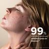 Clean Out - Nettoyant visage purificateur peau - SKIN & OUT