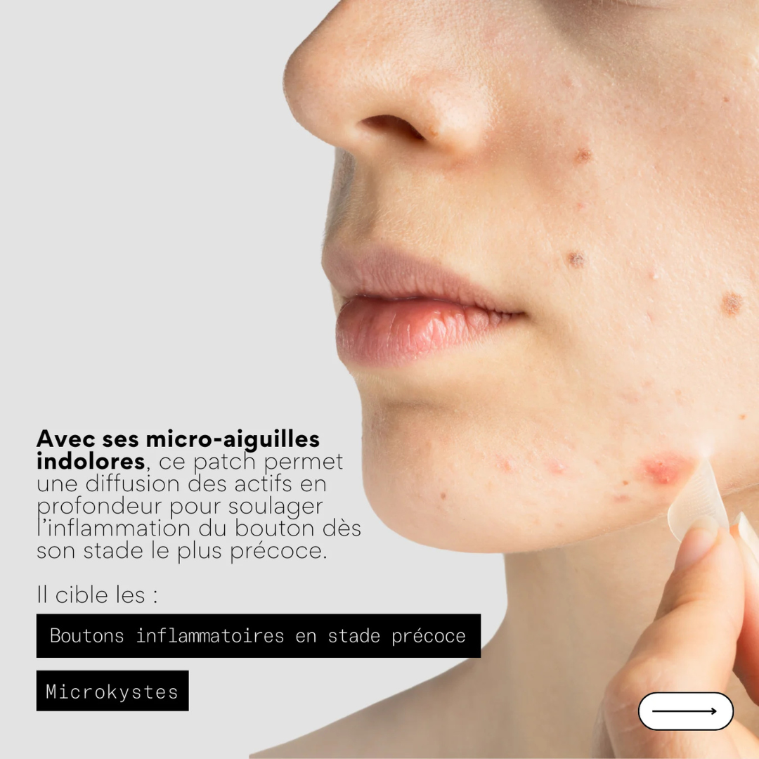 Clear Out - Patchs anti boutons micro aiguilles x9 - SKIN & OUT