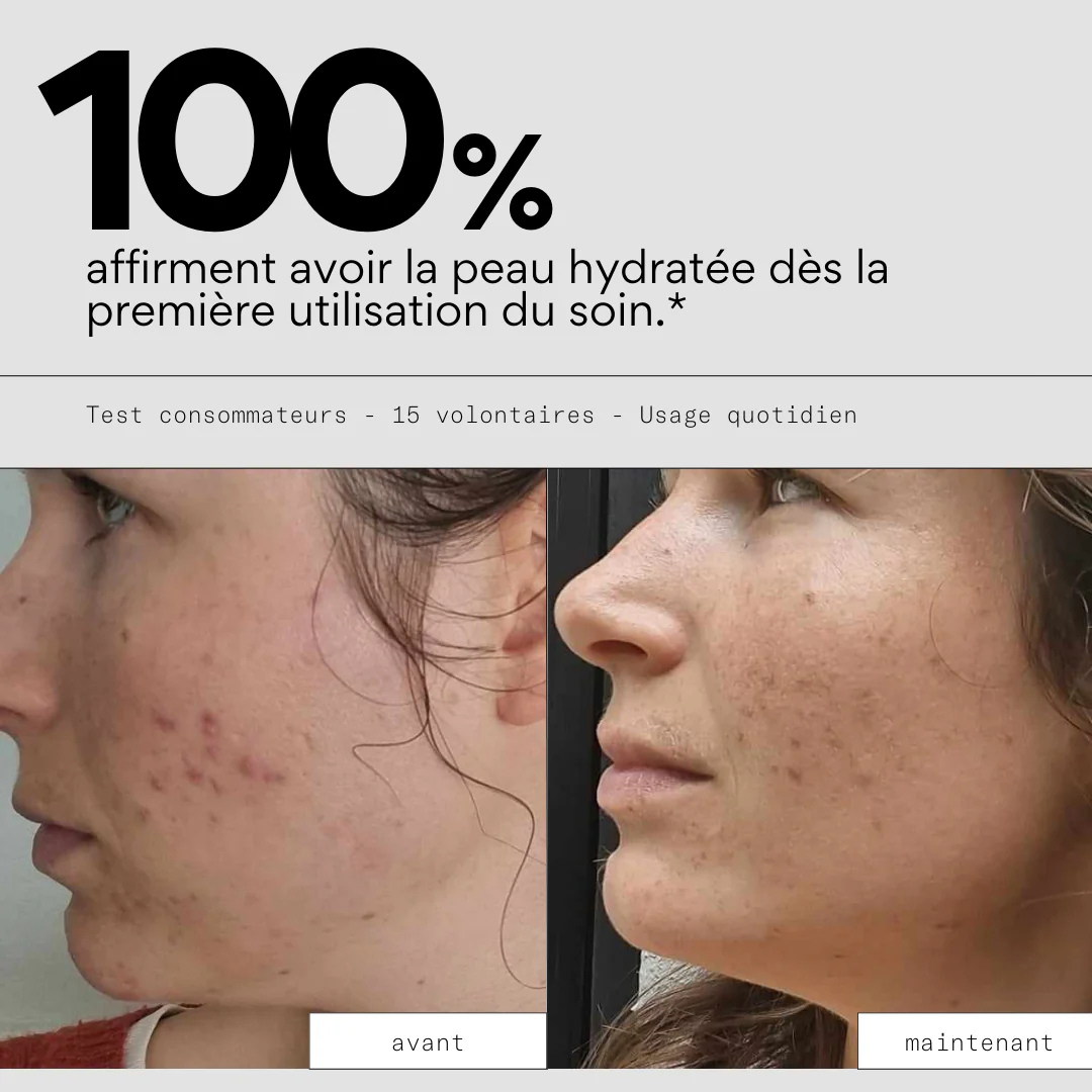 Feed Out - Crème hydratante pour les imperfections  - SKIN & OUT