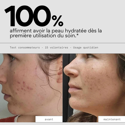 Feed Out - Crème hydratante pour les imperfections  - SKIN & OUT