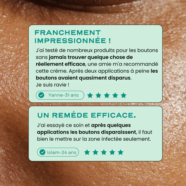 Neat Circles Acne Cream to Reduce Redness and Promote Healing