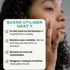 Neat Circles Acne Cream to Reduce Redness and Promote Healing