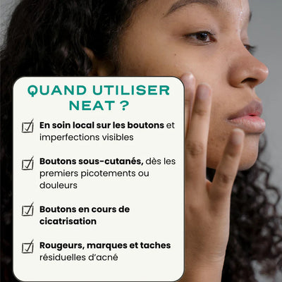 Neat Circles Acne Cream to Reduce Redness and Promote Healing