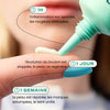 Neat Circles Acne Cream to Reduce Redness and Promote Healing