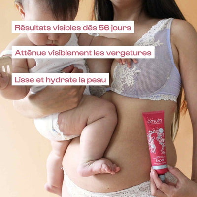 Crème anti-vergetures de grossesse - Omum