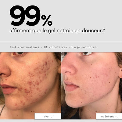 Clean Out - Nettoyant visage purificateur peau - SKIN & OUT