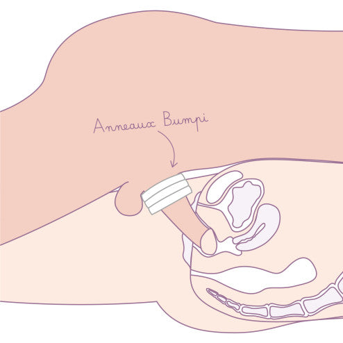 Schéma de l'utilisation des anneaux Bumpi lors de la pénétration - Gapianne