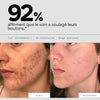 Soin anti-boutons aux prébiotiques - SKIN & OUT